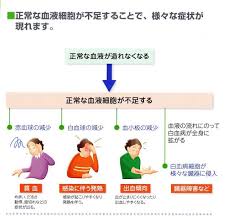 白血病を患った有名人は 白血病の初期症状 原因 余命をわかりやすくまとめました 癌は早期発見が大事なんだね