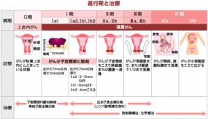 ステージ 1 の症状